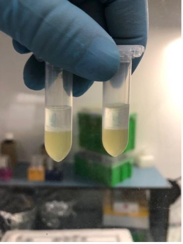Sputum MBLA web